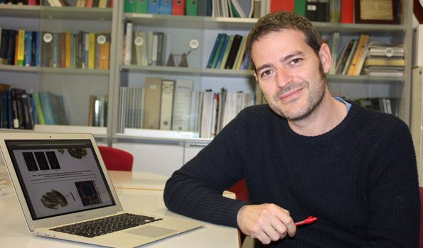 A estudio una nueva terapia con ondas ultrasónicas para tratar el Alzheimer A estudio una nueva terapia con ondas ultrasónicas para tratar el Alzheimer