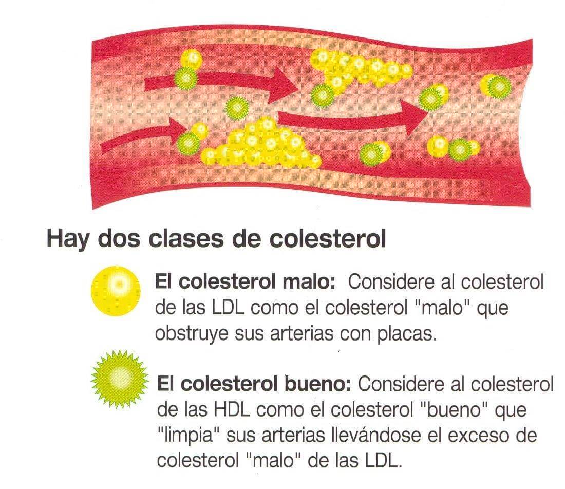 colesterol_malo_bueno1 colesterol y alzheimer Tabaco y colesterol influyen en la aparición del Alzheimer