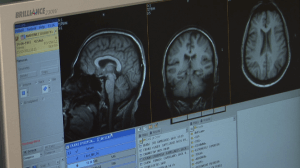 Joven, sano y familiar con Alzheimer?…Hacen un llamamiento para reclutar 400 voluntarios sanos, de entre 33 y 63 años, con parientes enfermos de Alzheimer