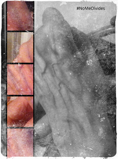 Foto: Alzheimer Universal / Cuidador Alzheimer