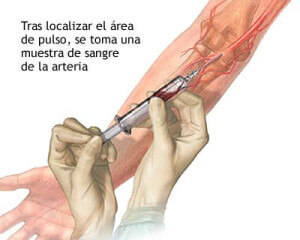 Imagen | ADAM