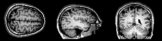 BrainMRI3planes_wikipedia