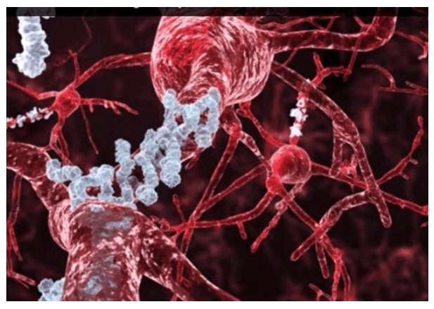NASA estudiará Alzheimer en gravedad cero El alzhéimer se genera por la acumulación de la proteína β-Amiloide (Aβ) en el cerebro Imagen Cortesía: NASA NASA estudiará Alzheimer en gravedad cero El alzhéimer se genera por la acumulación de la proteína β-Amiloide (Aβ) en el cerebro Imagen Cortesía: NASA