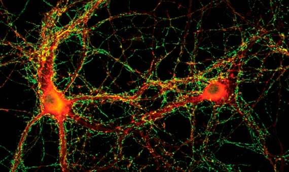 Últimos descubrimientos sobre la Memoria (Muy Interesante) Últimos descubrimientos sobre la Memoria (Muy Interesante) Sinapsis observada por microscopía epifluorescente. Crédito: Pietro de Camilli, Universidad de Yale